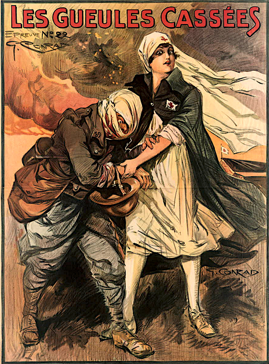 Les gueules cassées 1916-1918